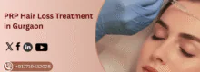 PRP for Hair Loss