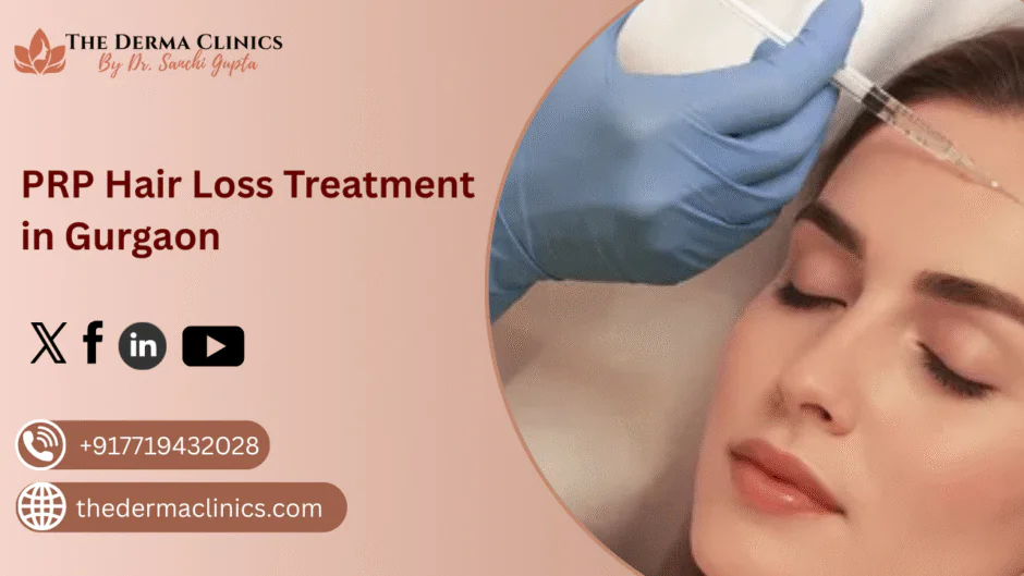 PRP for Hair Loss