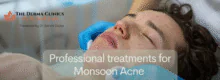 Top 5 Acne Treatments That Work Best in Gurgaon Weather