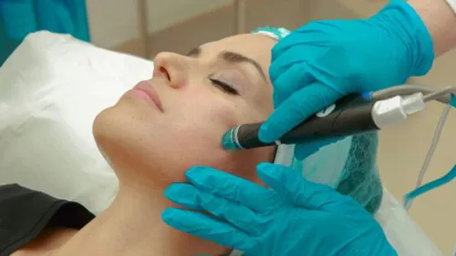 Pigmentation Treatment